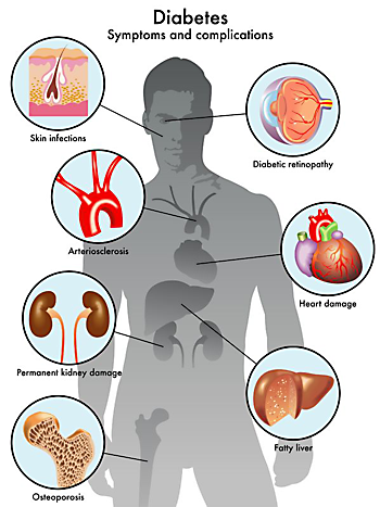 symptoms and complications of diabetes